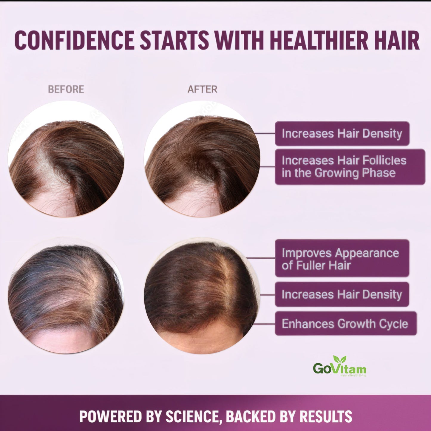 Hair Growth Accelerator Soft Chews, GoVitam® Hair Growth Vitamins for Women and Men with Clinically Studied Lustriva and Biotin, Promotes Thicker, Fuller, Stronger Hair, Mixed Berry, 60 Soft Chews